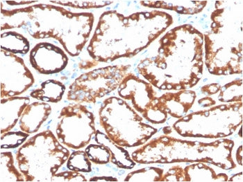 IHC staining of FFPE human renal cell carcinoma with biotinylated CD137 antibody (clone 4-1BB/3201).