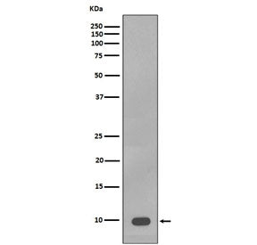 Western blot testing of human A375 cell lysate with S100 beta antibody. Predicted molecular weight ~
