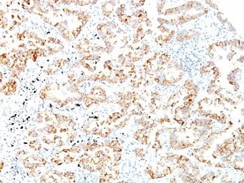 KRT7 Antibody / Cytokeratin 7