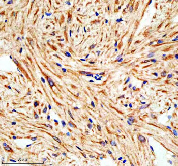 Immunohistochemical analysis of Lims1 protein using Zebrafish Lims1 antibody and paraffin-embedded z