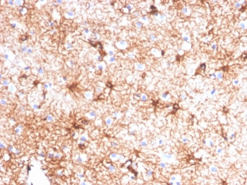 IHC staining of FFPE human cerebellum tissue with Glial Fibrillary Acidic Protein antibody (clone GFAP/4450). HIER: boil tissue sections in pH 9 10mM Tris with 1mM EDTA for 20 min and allow to cool before testing.