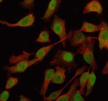Immunofluorescent staining of OTUD4 using anti-OTUD4 antibody (green) and anti-Beta Tubulin antibody