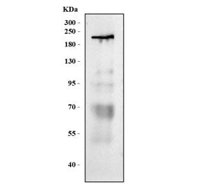 Western blot testing of human placental tissue lysate with VEGFR-1 antibody. Predicted molecular wei