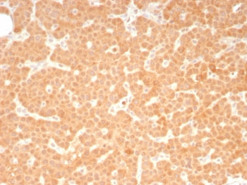 c-RET Antibody
