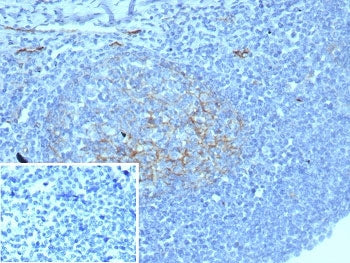 ICAM1 Antibody / CD54