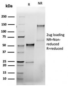 SDS-PAGE analysis of purified, BSA-free recombinant BCL2L1 antibody (clone rBCL2L1/4508) as confirma