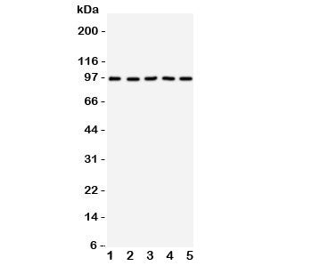 Western blot testing of TRKC antibody on Lane 1: rat brain; 2: mouse brain; 3: human U87; 4: (h) SHG