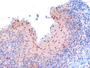 IHC testing of FFPE human tonsil with RANBP9 antibody at 3ug/ml. Microwaved antigen retrieval with T