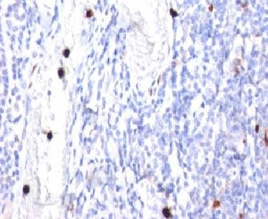 CSF3 Antibody / Granulocyte-Colony Stimulating Factor