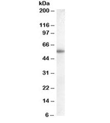 Western blot testing of human placenta lysate with Aromatase antibody at 0.1ug/ml. Predicted molecul