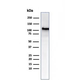 MSH2 Antibody