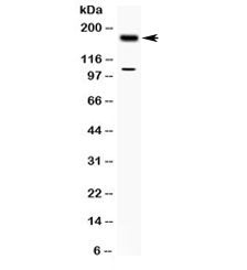 Western blot testing of human MCF7 cell lysate with TIAM1 antibody at 0.5ug/ml. Predicted/observed m