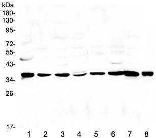 Western blot testing of rat 1) liver, 2) spleen, 3) brain, 4) kidney, 5) thymus, 6) PC-12, 7) RH35 a