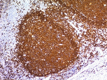 IHC staining of FFPE human tonsil tissue with CD20 antibody (clone L26). HIER: boil tissue sections 