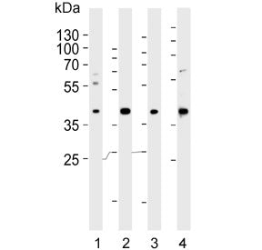 Western blot testing of human 1) A549, 2) HUVEC, 3) liver and 4) placenta lysate with LOX-1 antibody