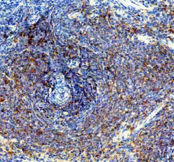 IHC staining of FFPE rat spleen tissue with PTP1B antibody. HIER: boil tissue sections in pH8 EDTA f