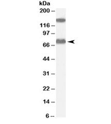 Western blot testing of human liver lysate with ACOX2 antibody at 0.1ug/ml. Molecular weight: the ex