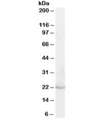 Lipocalin 2 Antibody