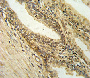 IHC testing of FFPE human prostate tissue with DFFB antibody. HIER: steam section in pH6 citrate buf