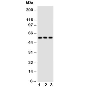 GLUT5 Antibody (Glucose transporter 5)