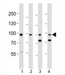 Ephb1 Antibody