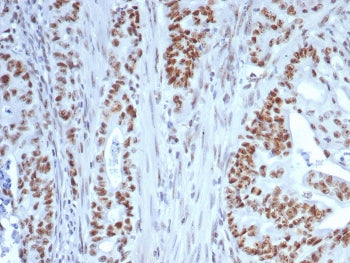 IHC staining of FFPE human colon tissue with Nucleolin antibody (clone NCL/7339). HIER: boil tissue 
