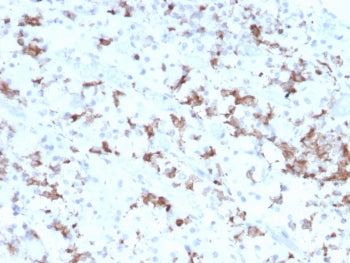 IHC testing of FFPE human pituitary tissue with Prolactin antibody (clone PRL/2641). Required HIER: 