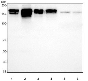 Western blot testing of 1) human HeLa, 2) human SiHa, 3) human A549, 4) human MCF7, 5) rat brain and