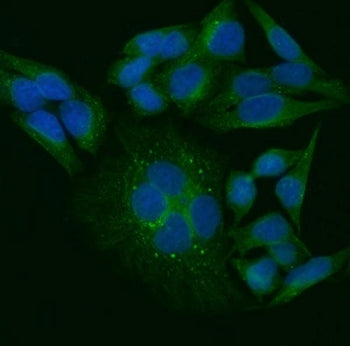 TRIP Antibody / TRAIP