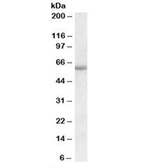 Western blot testing of human amygdala lysate with Cadherin 23 antibody at 1ug/ml. Predicted/observed molecular weight: ~60kDa.