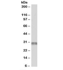 Western blot testing of human skeletal muscle lysate with TRIM7 antibody at 1ug/ml. Predicted molecu