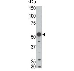Western blot testing of mouse kidney tissue lysate with BLK antibody. Expected molecular weight: 55-