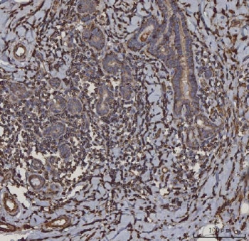 HLA-DRA Antibody