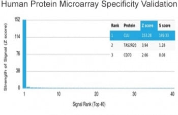 Analysis of HuProt(TM) microarray containing more than 19,000 full-length human proteins using Clust