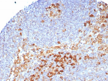IHC staining of FFPE human lymph node tissue with CD9 antibody (clone CD9/7416). HIER: boil tissue s