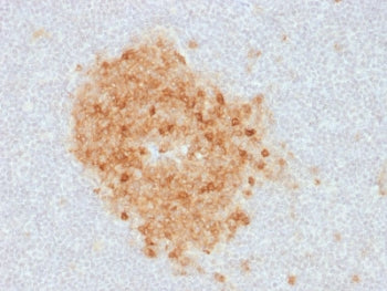 IHC staining of FFPE human tonsil with CD10 antibody (clone MME/1893). Required HEIR: boil tissue se