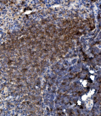 IHC staining of FFPE rat spleen with Ly6c antibody. HIER: boil tissue sections in pH8 EDTA for 20 mi