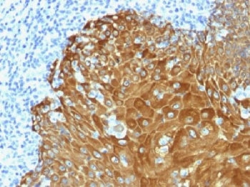 IHC staining of FFPE human skin with pan Cytokeratin antibody. Required HIER: boil tissue sections i