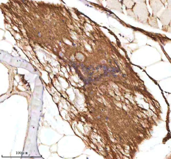 IHC staining of zebrafish Axin2 protein using Zebrafish Axin2 antibody, HRP-labeled secondary and DA