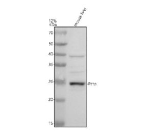 Western blot analysis of PCTP using anti-PCTP antibody. Electrophoresis was performed on a 12% SDS-P