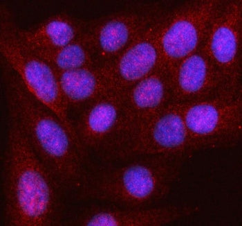 Immunofluorescent staining of FFPE human U-2 OS cells with HDDC2 antibody (red) and DAPI nuclear sta