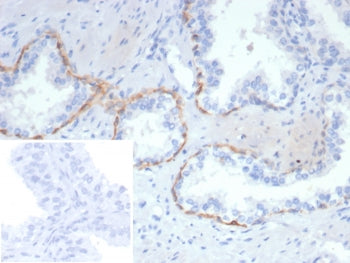 Cytokeratin 14 Antibody / CK14 / KRT14