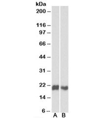 Western blot testing of Jurkat [A] and MOLT4 [B] lysates with CD3D antibody at 1ug/ml. Predicted mol