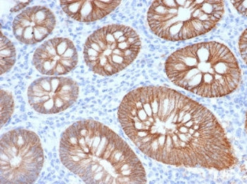 IHC staining of FFPE human colon tissue with S100 calcium-binding protein A14 antibody (clone S100A1