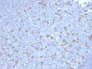 IHC staining of FFPE human tonsil with PDCD1 antibody (clone PDCD1/2720). HIER: boil tissue sections