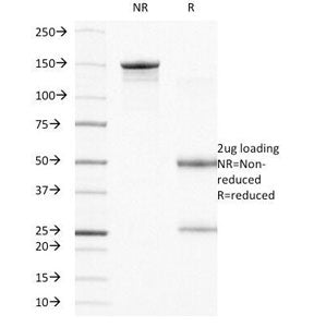 Integrin beta 4 Antibody / ITGB4 / CD104