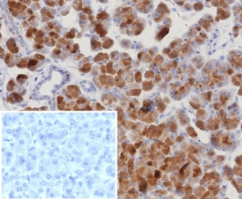 IHC staining of FFPE human pancreas tissue with ROR gamma antibody (clone RORC/8132R). Inset: PBS us