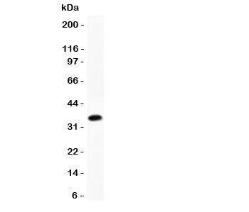 CCL17 Antibody