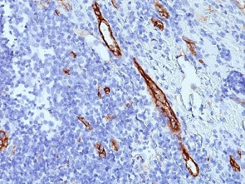 IHC: Formalin-fixed, paraffin-embedded human tonsil stained with anti-von Willebrand Factor antibody