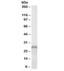 Western blot testing of human adrenal gland lysate with PHOX2A antibody at 1ug/ml. Predicted molecul